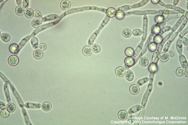 Candida spp under microscope, yogurt and candidiasis, candida albicans